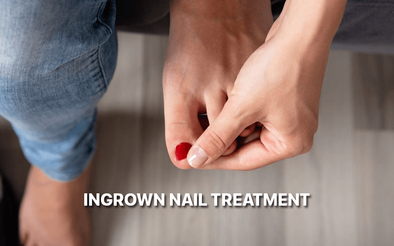 ingrown nail treatment