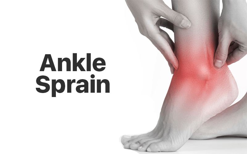 ankle sprain