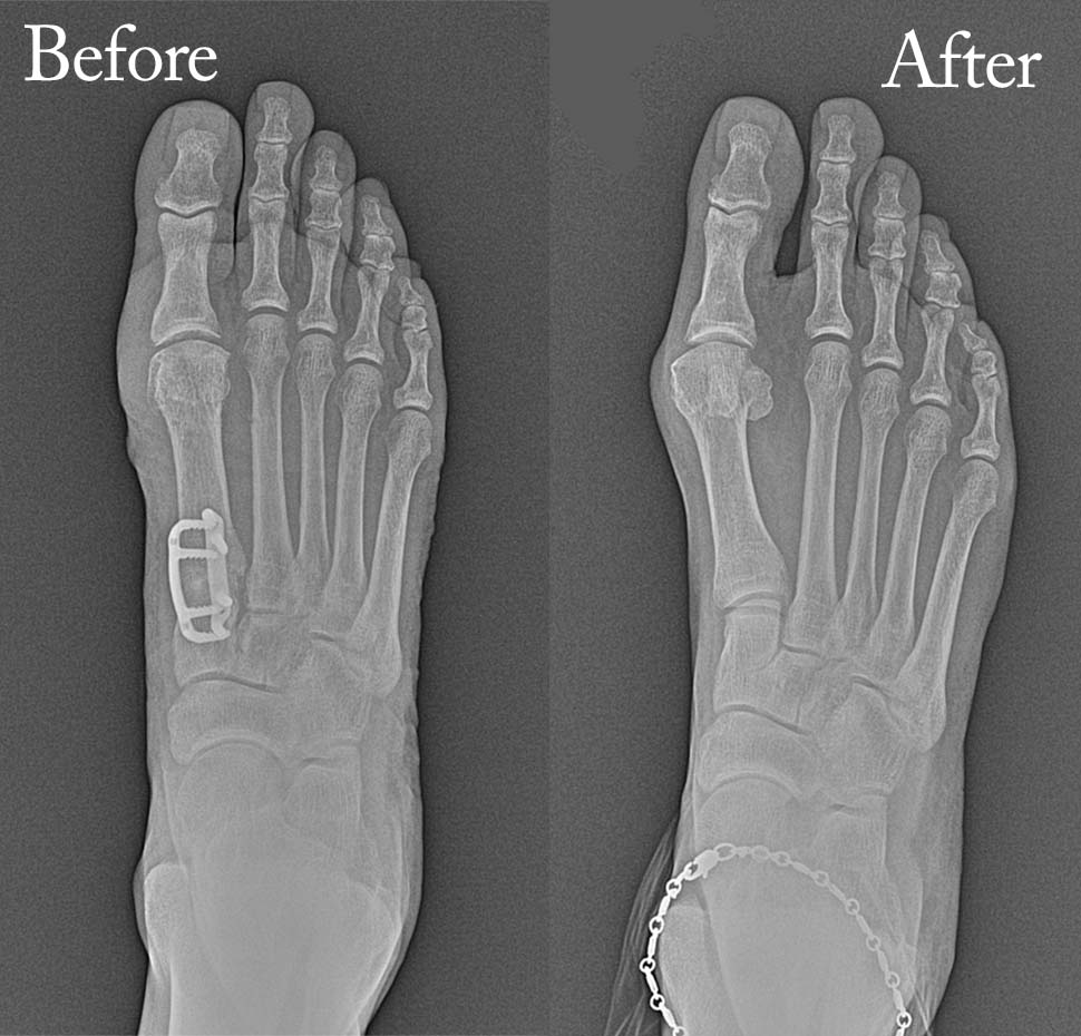 Before and after