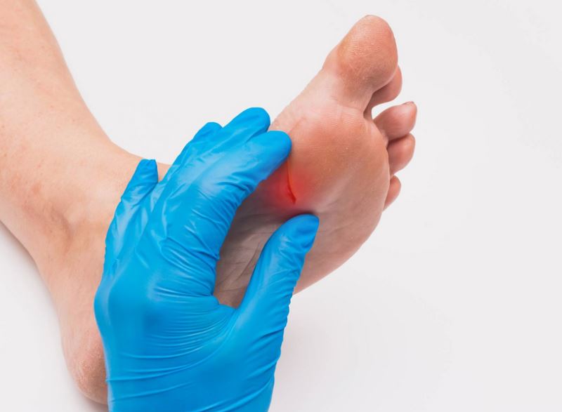 debaitic foot